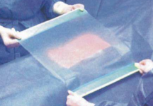 Verification of Tack of Sterile Surgical Film by Peel Strength Test